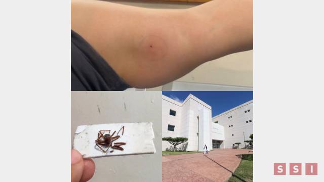 Susana Solis Informa SALVAN vida de mujer que sufrió picadura de araña violinista