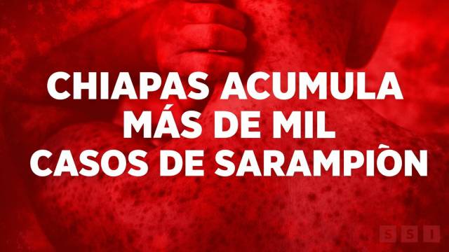 Susana Solis Informa Más de mil casos de sarampión colocan a Chiapas en tercer sitio nacional