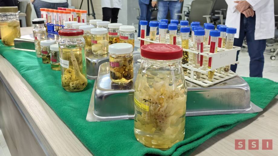 18 DECESOS por consumo de hongos en Chiapas en los últimos años: Secretaría de Salud - Susana Solis Informa