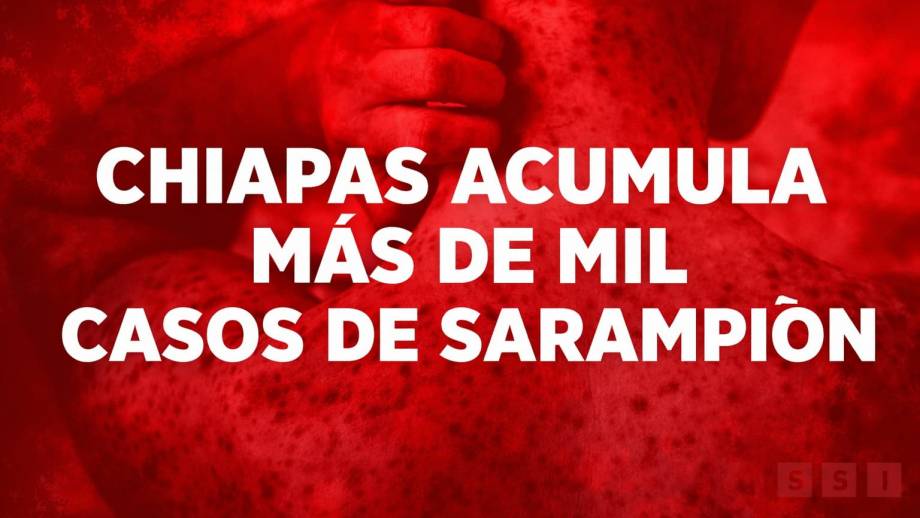 Más de mil casos de sarampión colocan a Chiapas en tercer sitio nacional - Susana Solis Informa